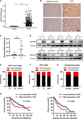 FBXO43 increases CCND1 stability to promote hepatocellular carcinoma cell proliferation and migration